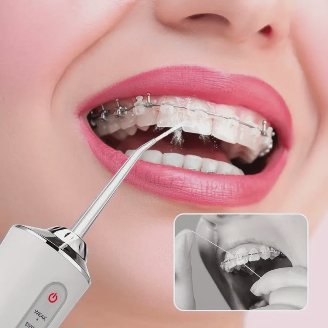IRRIGADOR BUCAL